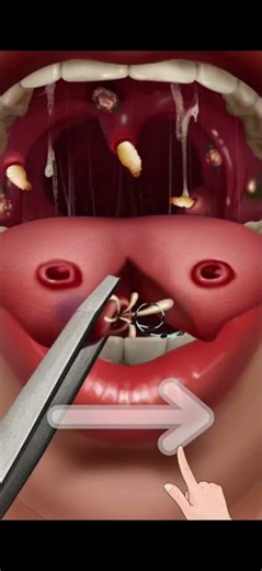 4K ASMR Deep Tongue Cleaning & Treatment