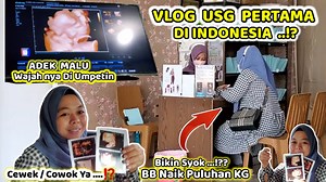 767K views · 19K reactions | Vlog USG PERTAMA Di Indonesia ⁉️ Cewek / Cowok Ya?? | Youtube Tina XL | Facebook