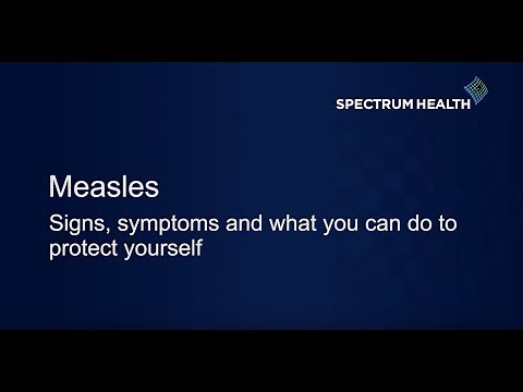 Measles: What you need to know.