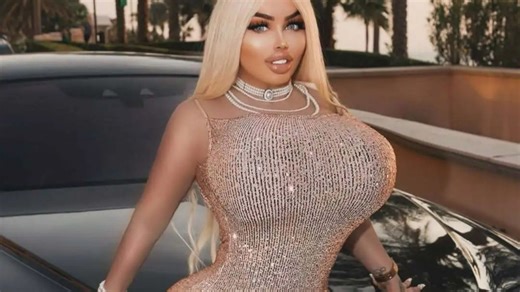 I've spent £168k on surgery, almost died & lost my pals as they're jealous of me