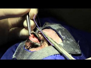 How the eyelids are stitched to heal the dog's eye ulcer - surgery