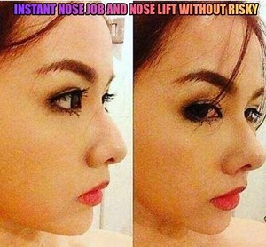 2.4K views · 5 comments | Instant nose job and nose lift without risky and costly surgeries! Get ready for a smaller, more defined, thinner and pointier nose. Get it here: https://wegoteverythingph.com/collections/new-arrivals/products/nose-lifter #WGE_Asia #nose #lifter #beauty #modify #selfesteem #instant #quickfix #surgery #quality #pointed #thinner #define | WGE_Asia | Facebook
