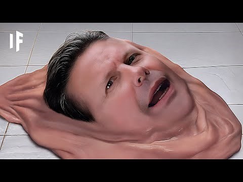 What If You Lost Your Bones?