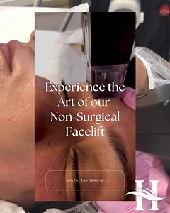 Experience the Art of our Non-Surgical Facelift Benefits: ☑️No downtime ☑️FDA Approved ☑️Fine lines/ wrinkles ☑️Dullness ☑️Skin laxity Book your transformation today, call (571)5020202 now 🤩 * * * * #Healthydermis #MedSpa #opusplasma #opusplasma #skincare #laserhairremoval #personalcare #dysport #nonsurgicalfacelift #fda #treatment #almalasers #botox #tattooremoval #fillers #buttlift #hydrafacial #plasmaresurfacing #radiofrequency #juvederm #injectables #neurotoxintreatment #botoxoaktonva #inmo