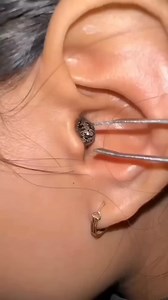 Fairness Bridal Face Pack, Party Instant skin whitening mask #beauty #fairness #skinwhitening | Dr.Priyanka