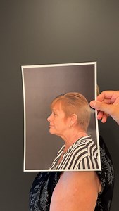 1.1K views · 14 reactions | Adult Content | All plastic surgery is...