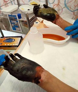 What Is GBS Infection? Source Not Found; Singapore Authorities Issue Advisory to Avoid Raw Fish Food