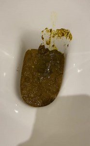 Urgent diarrhea aftermath