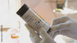 A laboratory technician is comparing a reagent strip (dipstick) for urinalysis with reference colour chart values.