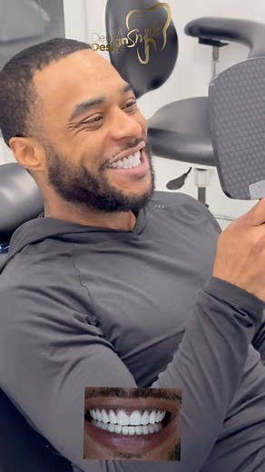 5.4K views | Witnessing the expressions of satisfaction and joy on our patients’ faces is what fuels our passion and dedication. We take pride in providing them with confidence and a dazzling smile that will accompany them on all their adventures.醴❤️ #RadiantSmile #PorcelainDentalDesign #DentalTransformation #Confidence #DentalAesthetics #QualityDentistry #ExpertTeam #perfectsmile✨ | Dental Design Smile | Facebook