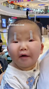 The up-slanting appearance of the palpebral aperture in Asians is frequently derived not from the anatomically positive canthal tilt, but from combined effects of the epicanthus and the up-slanting lateral half of the lower eyelid. The shape of one's eyelid does not usually interfere with field of view so they can see as much as any other person. #kbkfoundation | Kbkonline