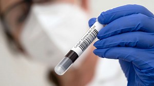 Coronavirus-Tests: Wie sicher sind sie? Was gibt es zu beachten?