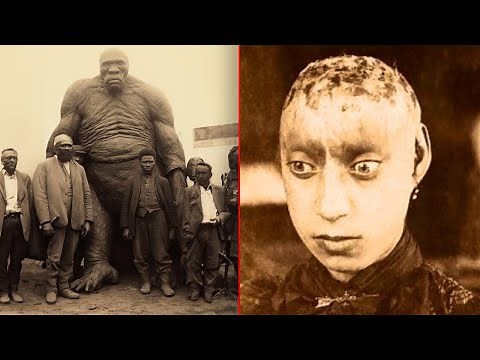 15 Most Shocking Real Circus Freaks Ever Lived