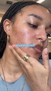 The biggest Drench & Quench Stan, Social Media Manager, Nadia: "Drench & Quench is definitely approved for my acne-prone skin! For the longest time I was afraid of using super hydrating products on my oily skin, but the Drench & Quench Moisturizer easily absorbs into my skin and doesn't make me breakout!" 💧 Find yours on Amazon.com #ThisisBliss #Hydratingmoisturizer #Dupe #Drenchandquench #Dermatologistapproved #Creamtowater | Bliss