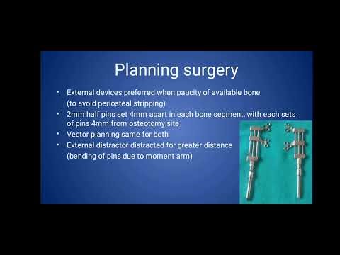 Distraction Osteogenesis