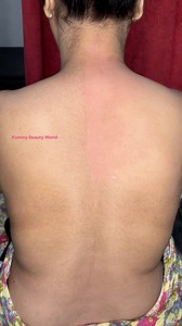 28K views · 227 reactions | Full Back Waxing for Bride to be/ #Backwaxing #skincare #beauty #hairremoval ​⁠#wax ​⁠Pre Bridal Waxing/ Full back Waxing tutorial / #skincare #beauty #ricawax ⁠#waxing @pummybeautyworld @sonimakeover @PummyBeautyParlour nape shave pummy beauty parlour pummy beauty world back waxing waxing face waxing nape waxing rica wax Pummy Beauty World | Pummy Beauty World | Facebook