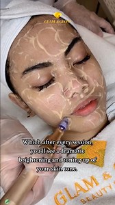 "Glow like never before with BB Glow! ✨ This skin-perfecting treatment evens out tone, reduces redness, and gives you a radiant glass-skin finish. Perfect for anyone who loves effortless beauty! 💖 Ready to glow? 📲 DM us to book! #BBGlow #GlassSkinGoals #RadiantComplexion #bbglowph #glamandglowph #EffortlessBeauty #GlowUp | Glam And Glow Beauty Expert