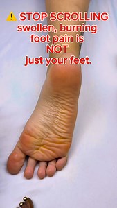 ⚠️ STOP SCROLLING — swollen, burning foot pain is NOT just your feet. Ever wake up with heel pain, arch tightness, or swelling that won’t go away? In holistic & meridian-based work, this area of the foot is often linked to LIVER meridian stagnation — especially when pain feels deep, hot, or inflamed. Here’s what that can show up as 👇 • Swollen feet or heels • Sharp plantar pain • Morning stiffness • Burning or pulsing sensation • Emotional pressure, irritability, stress overload When circulatio