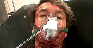 Tom Lowe Recounts Near-Death Wipeout at Teahupo’o