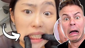 13K views · 189 reactions | There’s yellow… and then there’s highlighter yellow  #DentalHygienistWeek #HealthySmile #DentalComedy #SmileGoals | TheBentistofficial | Facebook