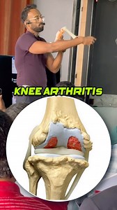 177K views · 534 reactions | My injury prevention workshop  | Sandy Jacob | Facebook