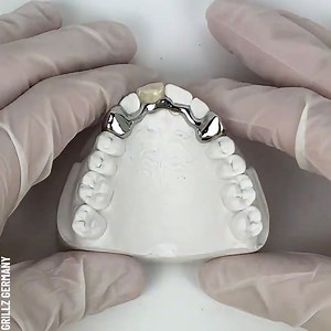 41K views · 194 reactions | Creating Custom Dental Grills for Missing Teeth Partner: Grillz Germany | Bored Panda Art | Facebook