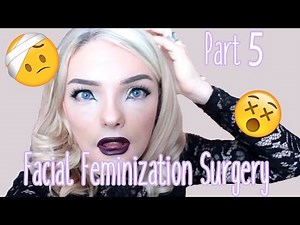 Facial Feminization Surgery - Week 2! | | Stef Sanjati