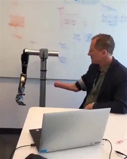 11 reactions | Explore the magic of AI with Atom Limbs Bionic Arm! This cutting-edge technology connects directly to human bones and nerves, offering natural movement, reducing pain, and mimicking functions like finger movement and gripping. A true marvel in tech evolution! 烙 #AI #BionicArm #ScienceGuys #TechInnovation | Roastbrief | Facebook