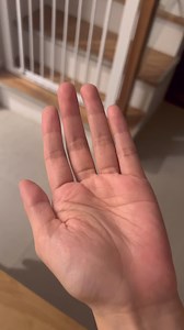 1.1K views · 17 reactions | Do experts recommend using any kind of baby powder? The American Academy of Pediatrics has long recommended against the use of baby powders that contain talc, because of both inhalation concerns and potential cancer risks. Source: https://time.com/6269007/baby-powder-talc-vs-cornstarch/ | Ayu Alano Llanes | Facebook