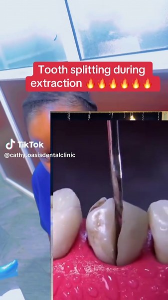cathy.oasisdentalclinic on TikTok