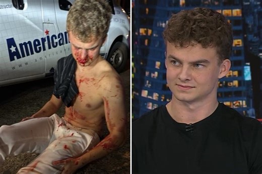 Former DOGE staffer Edward Coristine describes brutal DC attack by teen gang