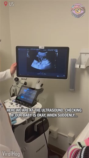 87K views · 126 reactions | Pregnant woman is left in awe during ultrasound | 5-Minute Crafts GIRLY | Facebook