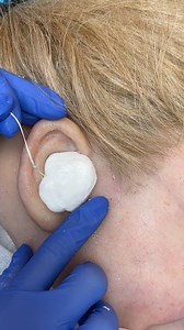 52K views · 117 reactions | They removed this from her ear This original video was produced by Network Media and MC Has Fun. | American Short Film Depot | Facebook