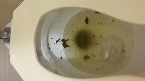 2-25-20 Same toilet. 3 hrs later. Diarrhea, farts, piss