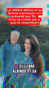 20K views · 216 reactions | Un célèbre albinos marié avec une femme mannequin a présenté leur fils, vous allez être choqué de découvrir son visage #story #histoire #mannequin | The Joy Feed | Facebook