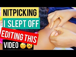 ASMR ALL ZOOMED IN NITPICKING || ODDLY SATISFYING