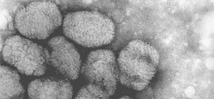First Drug for Smallpox Treatment | Drug Discovery And Development