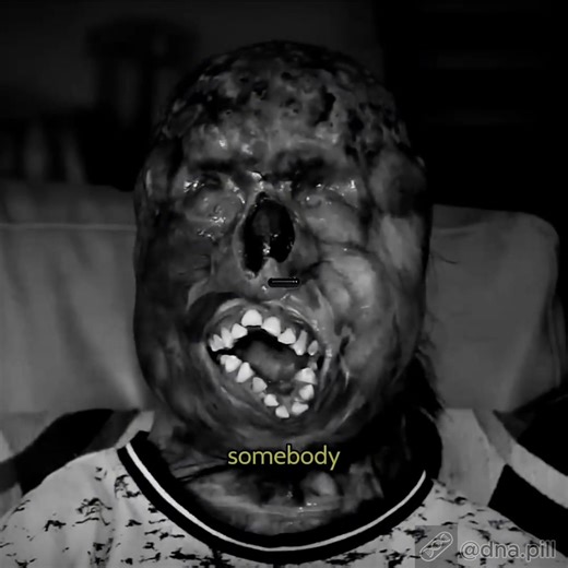 Brutal BP Edit Showcase by @kingclavicular