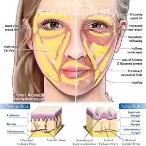 2.8K views · 58 reactions | Super Face Facial What GFx & PRP Helps you stimulate your facial Collagen and Elastin Fibers Wanna Special Promo All Procedures only done By Doctors !! #prptreatmentvampirefacial #cantik #vampire #glow #flawless #facial #aesthetics #model #actor @@@@@@@@@@@@@@ @jannanick @neelofa @noradanish bila nak visit  | The KL Sky Clinic | Facebook