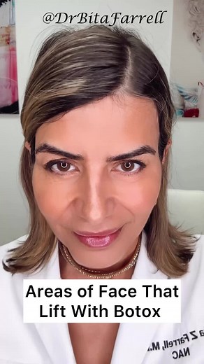Understanding Facial Muscles and Botox Benefits