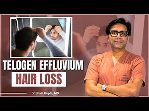 3 Common Causes of Telogen Effluvium Hair Loss You Need to Know | Dr Shaiil | Satya Hair Clinic