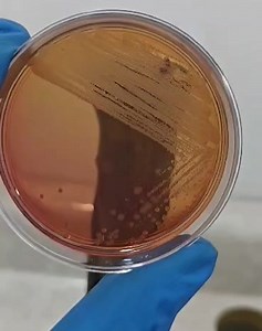 Lactosa negativas en Agar MacConkey 🧫🧫🧪🧪😍😍🦠🦠🦠🦠 | Microbiology Art