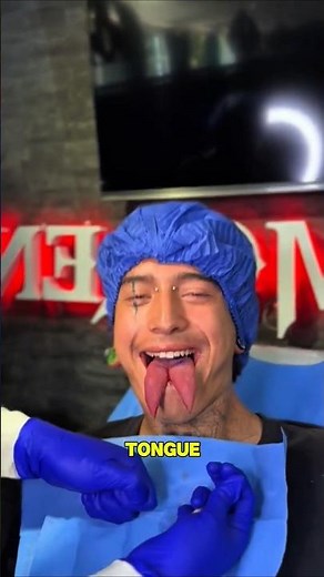 Some people split their tongue as a form of extreme body modification.