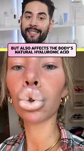 768K views · 1K reactions | Filler Dissolving Is Melting People's Faces! #beauty #skincaretips #skincare #tiktok #skincareroutine #reels | James Welsh | Facebook