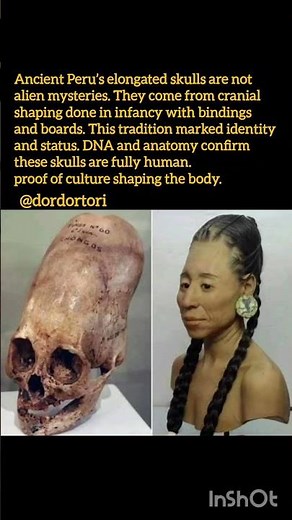 Alien Skulls? The Real Answer Will Surprise You, #history #facts #historyfacts #shorts