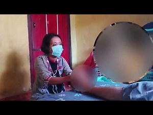 JIGGER Removal | JIGGER Diging | JIGGER Larvae Treatment on legs👣👣NN0028