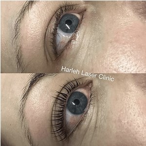 Yumi Lash Lift | Harleh Laser Clinic Pukekohe