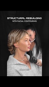 196K views · 667 reactions | Structural Rebuilding Through Facial...