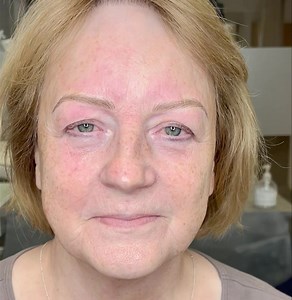 Hyperrealism is the NEW microblading! 🙏🏽🙏🏽 Unlike Microblading: There’s minimal pain, bleeding, cutting, scraping, incisions, or scarring. It’s the most gentle, safest, and most natural brow tattoo in the world! 🌎 Expect to take a nice nap 💤 and wake up with amazing brows just like these! 👇🏽 Wana be next? Just comment “ME NEXT” for info and prices. 👇🏽💕🙌🏽 | Hyper Realism UK by Mary Spence