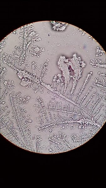 Exploring Human Tears Under a Microscope